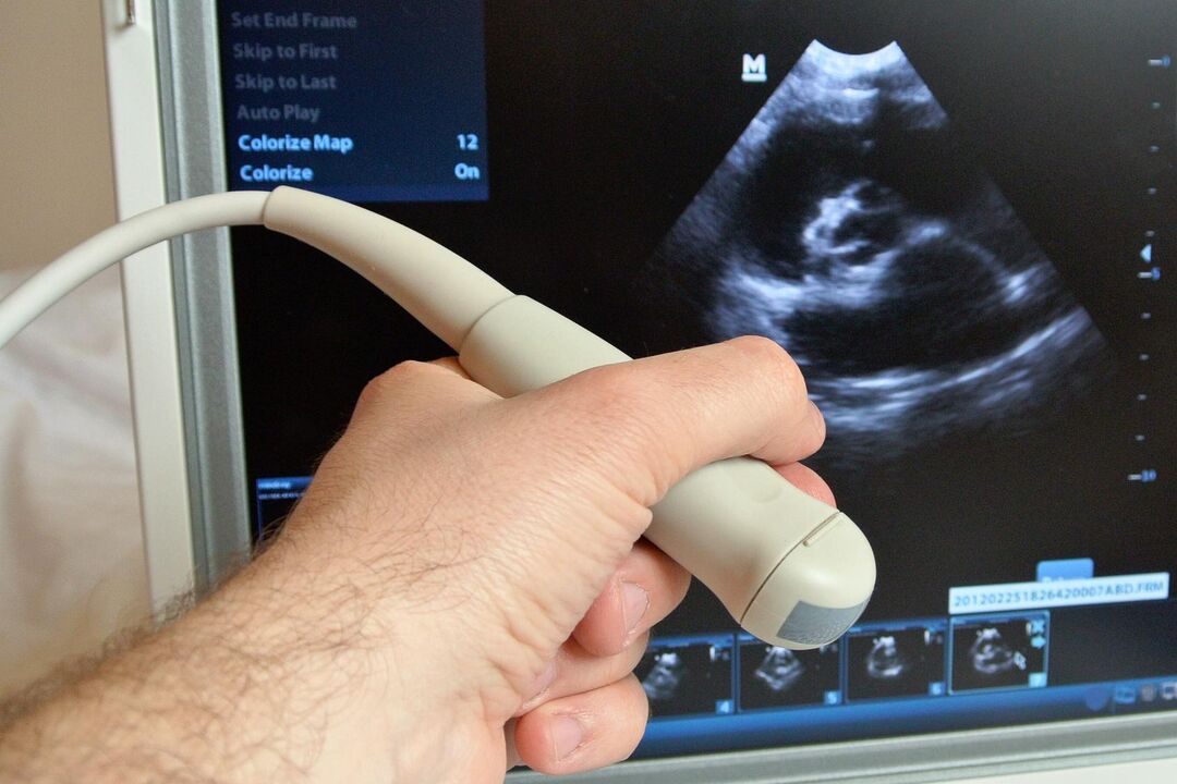 Ultrazvuk će pomoći u dijagnosticiranju kongestivnog prostatitisa kod muškaraca