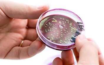 Bakterije u sekretu prostate